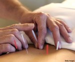 Nuestra fe: La acupuntura: por Dr. Carlos Etchevarne, Bach. Teol.