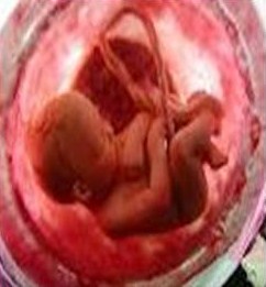 Salmo 138 (139). Domingo 24 de Junio de 2012.