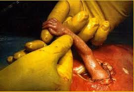 Salmo 45 (46). Martes 1 de Abril de 2014.