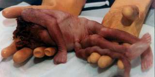 Meditación de las Horas Nocturnas V. Reparad por las almas involucradas en el horrible crimen del aborto.